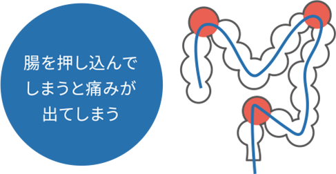 腸を押し込んでしまうと痛みが出てしまう