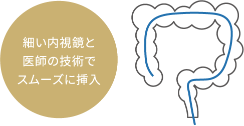 細い内視鏡と医師の技術でスムーズに挿入